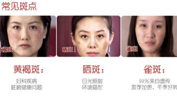 肝癌都是拖出來的，肝好不好要看這幾個表現！
